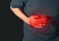 Egyre több a hepatitis A-fertőzés Magyarországon
